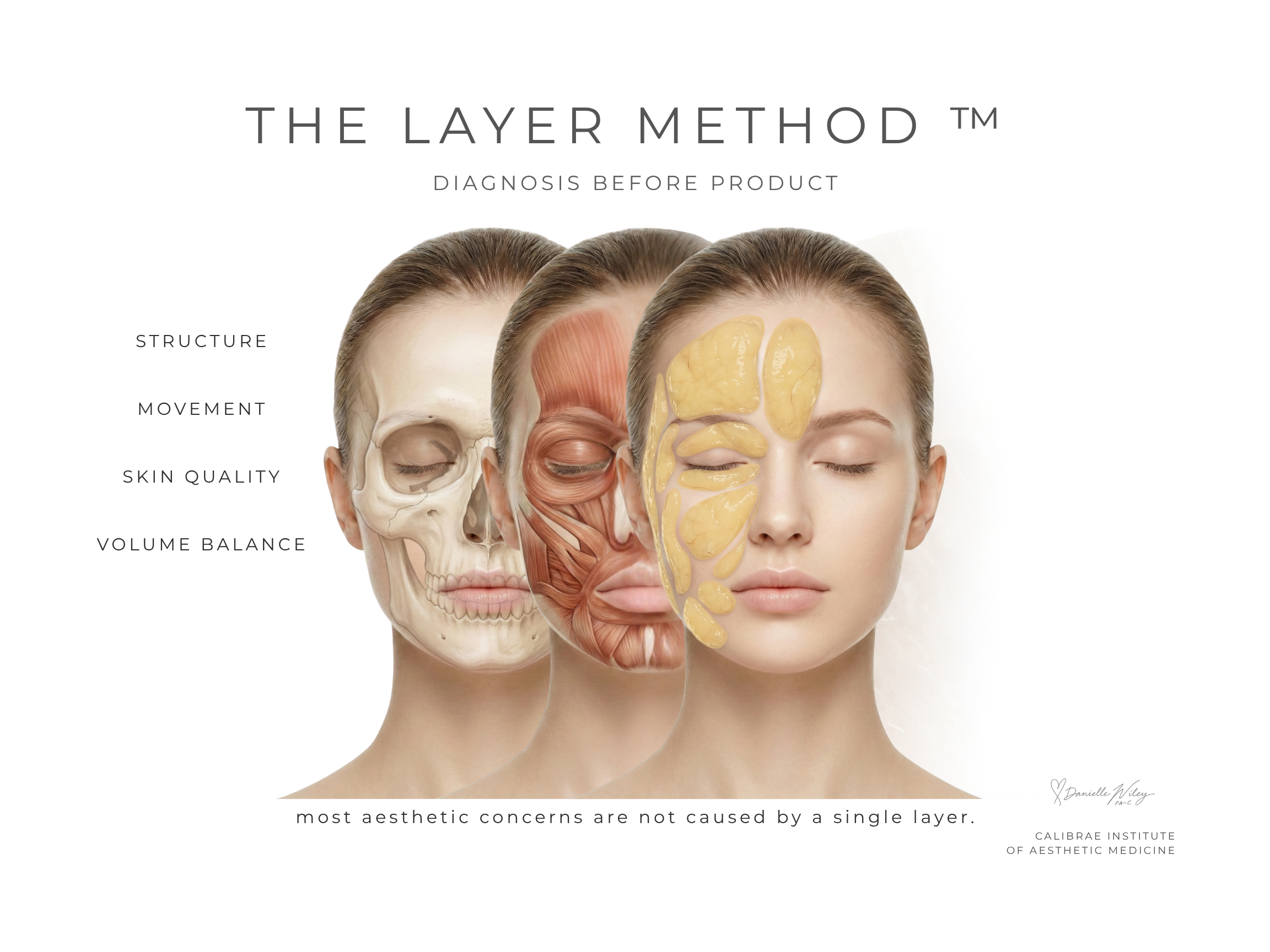 Calibrae The Layer Method anatomical artwork illustrating structure, movement, skin quality, and volume balance